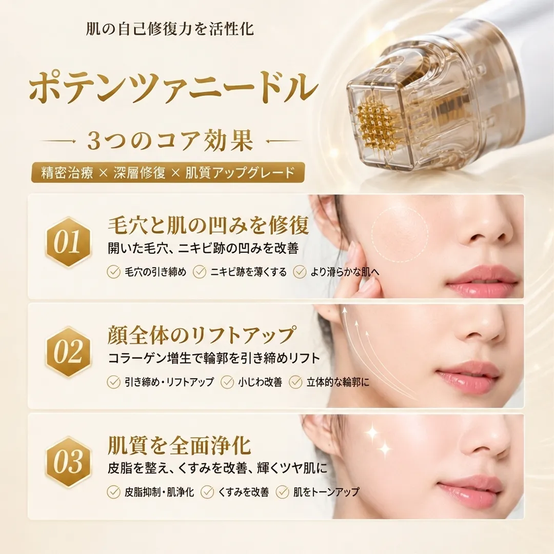 江南ポテンツァ：毛穴・ニキビ跡・ハリ改善ならマイクロニードルRF
